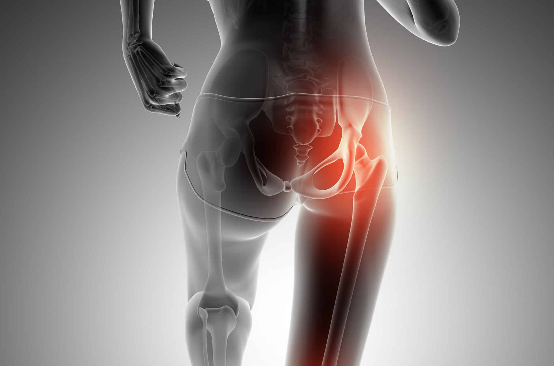 rotura del labrum