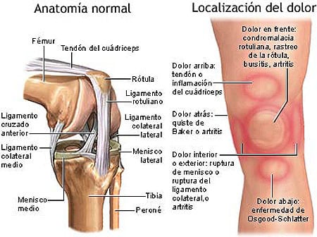 Lesión de rodilla, ¿Cuál tienes? - CAMDE - Málaga