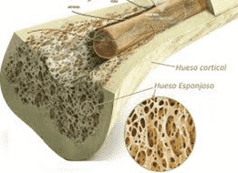 Tratamiento para edema oseo tobillo
