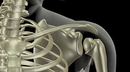 nudo Criatura autómata Fractura de clavícula: causas y tipos de tratamiento - Camde