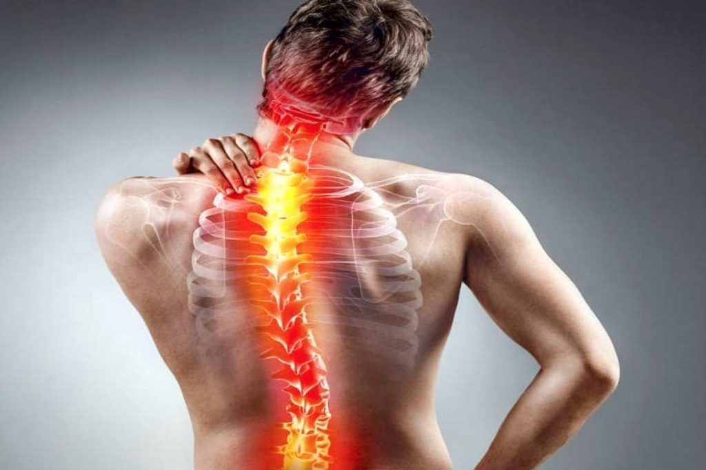 escoliosis