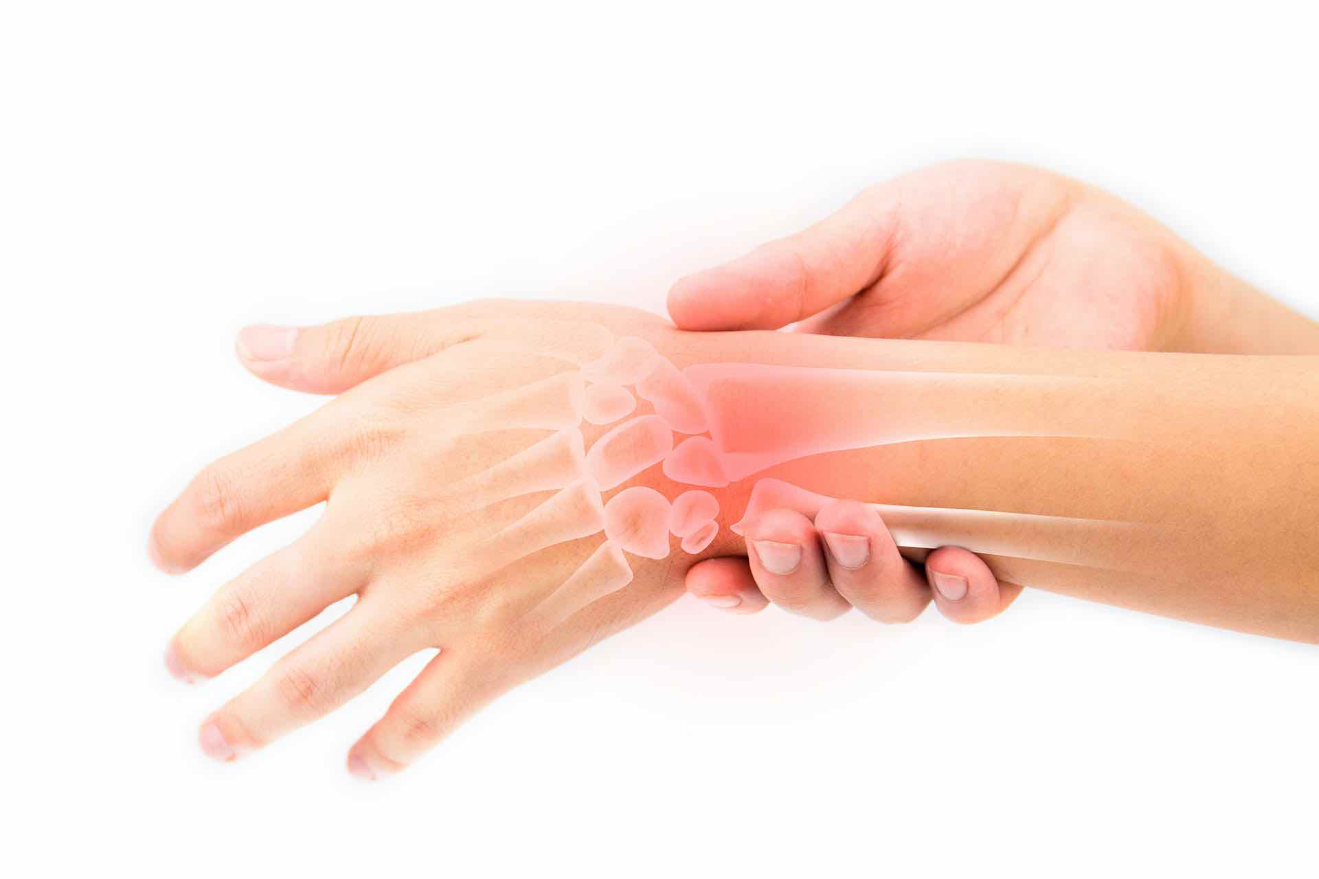 Artritis Reumatoide: Comprender y Sobrellevar una Enfermedad Crónica