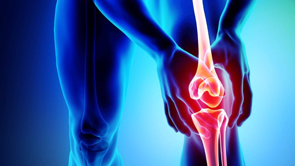 osteoartritis