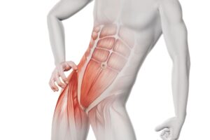hernia inguinal