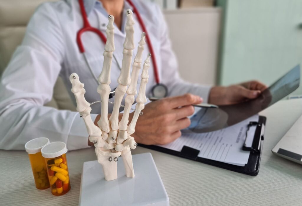 Fractura con Desplazamiento