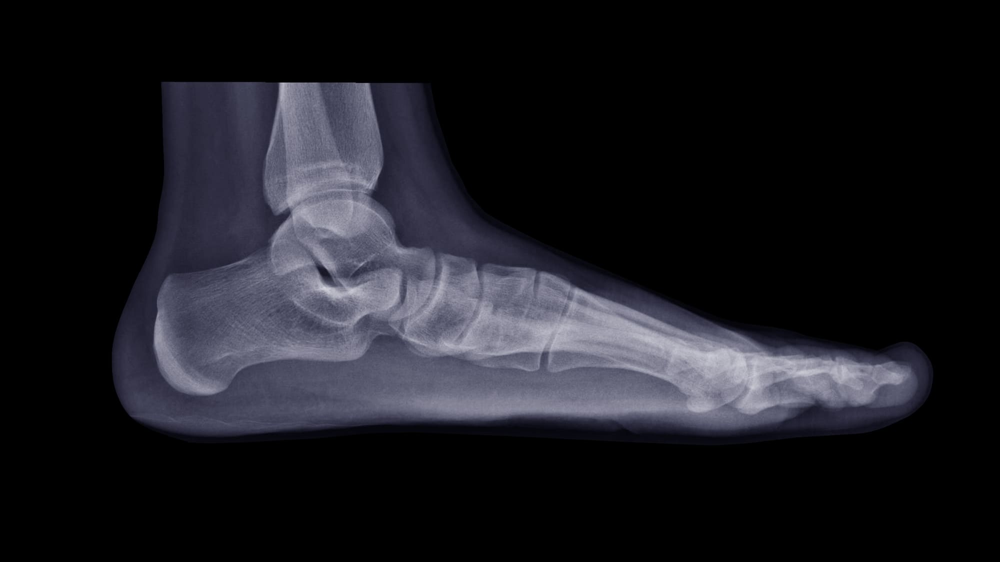 huesos del pie